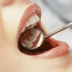 Dental Mirror